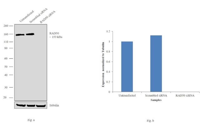 RAD50 Antibody in Western Blot (WB)