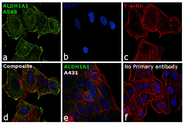 ALDH1A1 Antibody in Immunocytochemistry (ICC/IF)