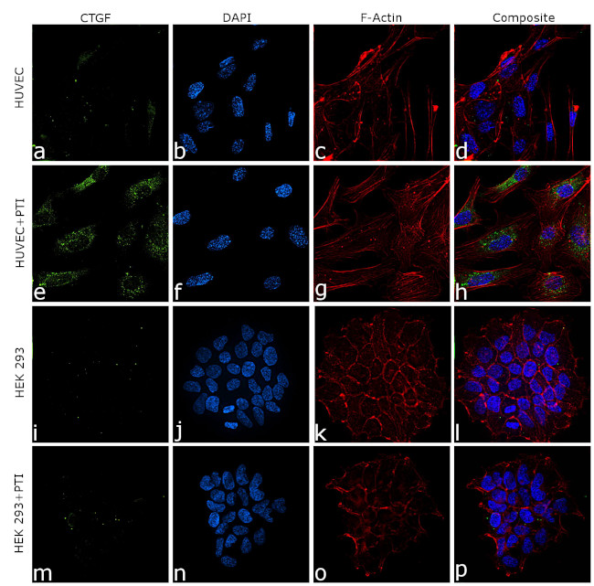 CTGF Antibody