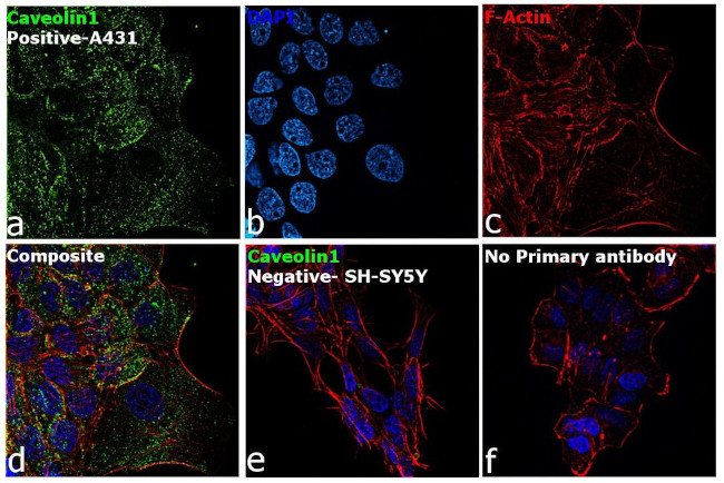 Caveolin 1 Antibody in Immunocytochemistry (ICC/IF)