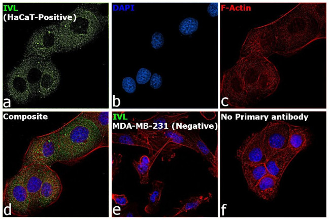 Involucrin Antibody in Immunocytochemistry (ICC/IF)