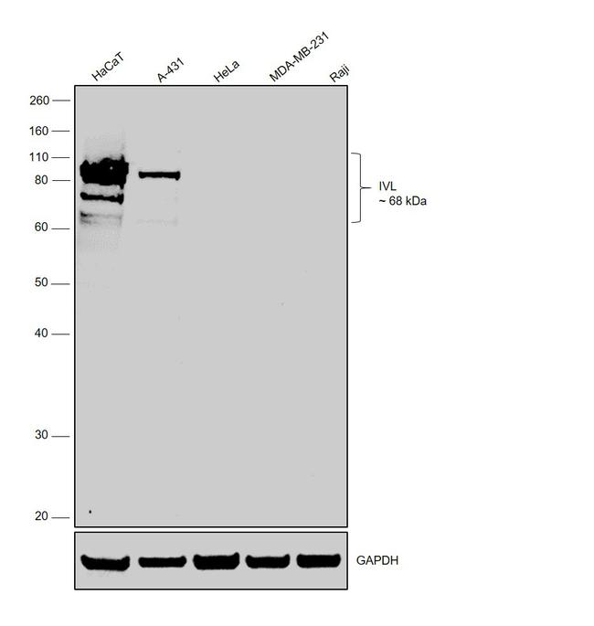 Involucrin Antibody in Western Blot (WB)