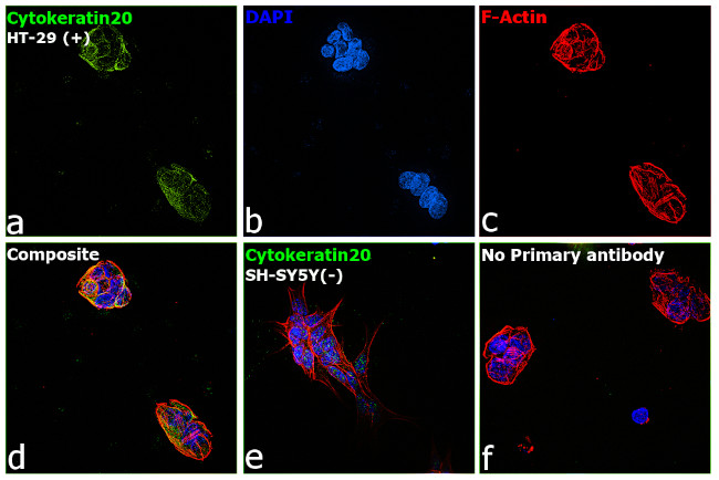 Cytokeratin 20 Antibody in Immunocytochemistry (ICC/IF)