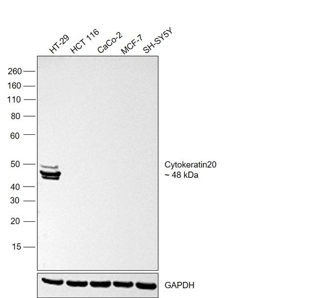 Cytokeratin 20 Antibody in Western Blot (WB)