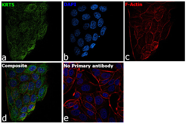 Cytokeratin 5 Antibody in Immunocytochemistry (ICC/IF)