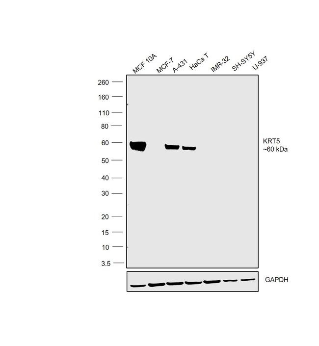 Cytokeratin 5 Antibody in Western Blot (WB)