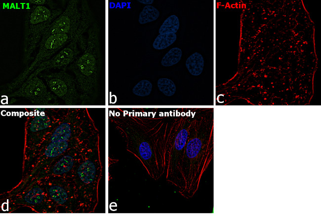 MALT1 Antibody in Immunocytochemistry (ICC/IF)