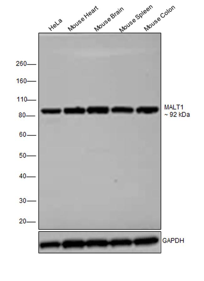 MALT1 Antibody in Western Blot (WB)