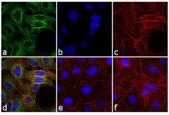 Rat IgG (H+L) Cross-Adsorbed Secondary Antibody in Immunocytochemistry (ICC/IF)