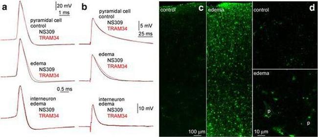 KCNN4 Antibody in Immunohistochemistry (IHC)