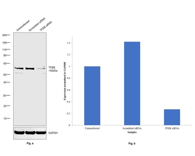 TFEB Antibody in Western Blot (WB)