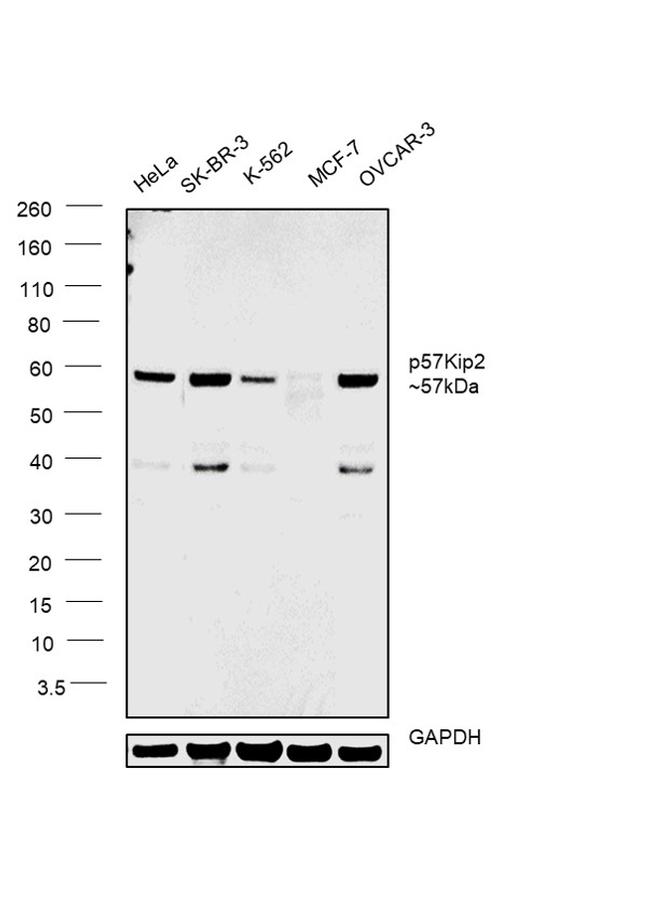 p57 Kip2 Antibody in Western Blot (WB)