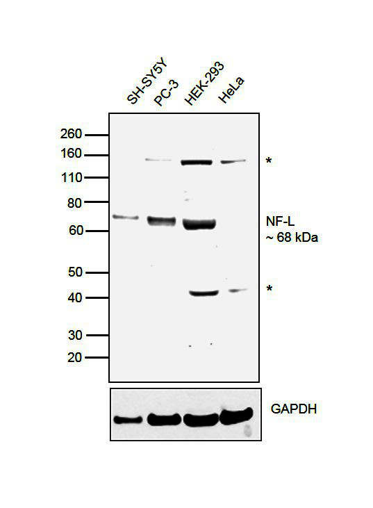 NEFL Antibody