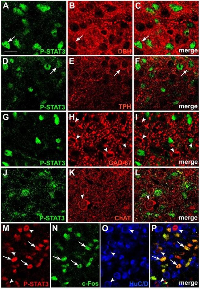 Dopamine beta Hydroxylase Antibody in Immunohistochemistry (IHC)