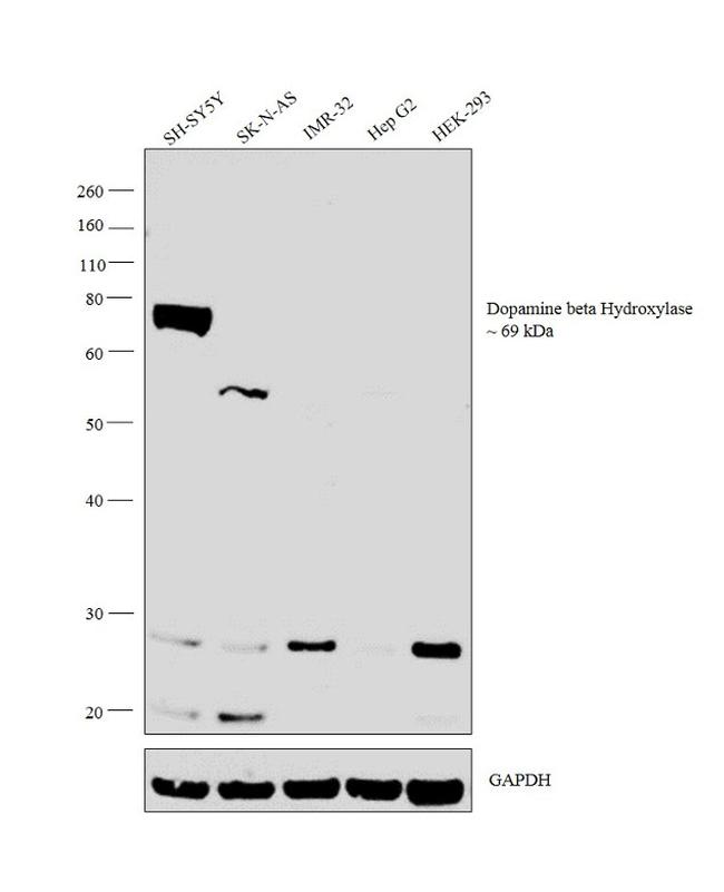 Dopamine beta Hydroxylase Antibody in Western Blot (WB)