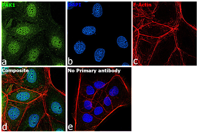 PAK1 Antibody in Immunocytochemistry (ICC/IF)