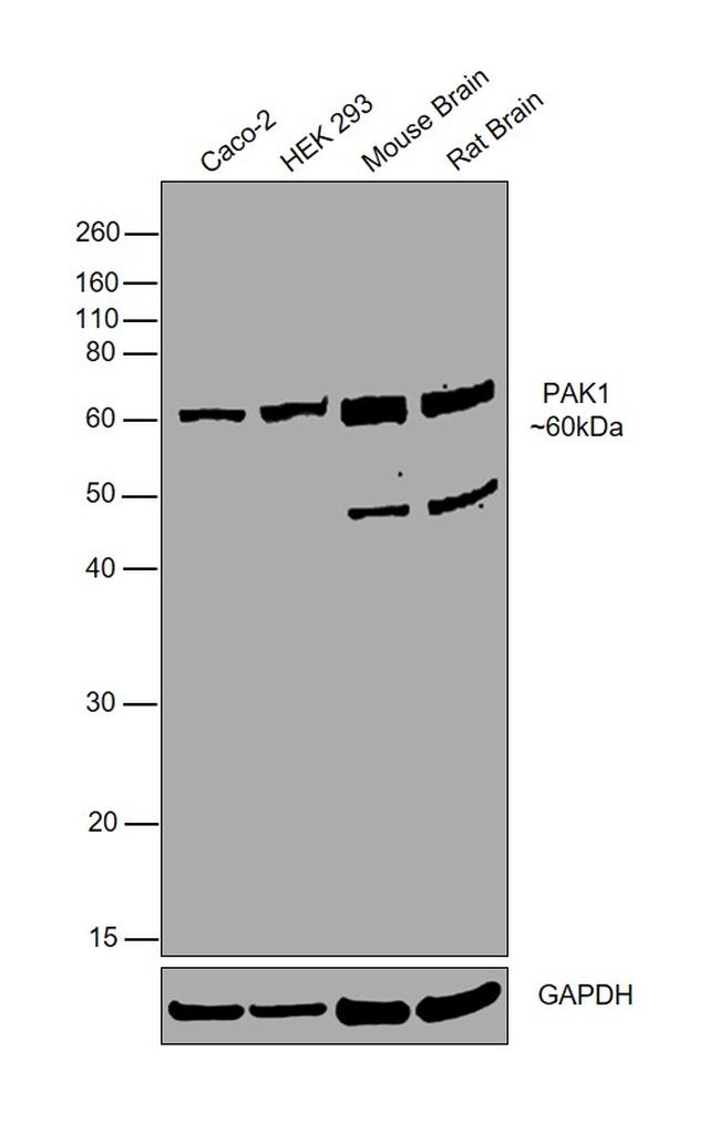 PAK1 Antibody in Western Blot (WB)