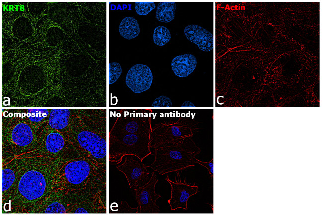 Cytokeratin 8 Antibody in Immunocytochemistry (ICC/IF)