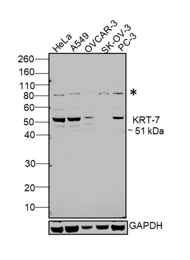 Cytokeratin 7 Antibody in Western Blot (WB)