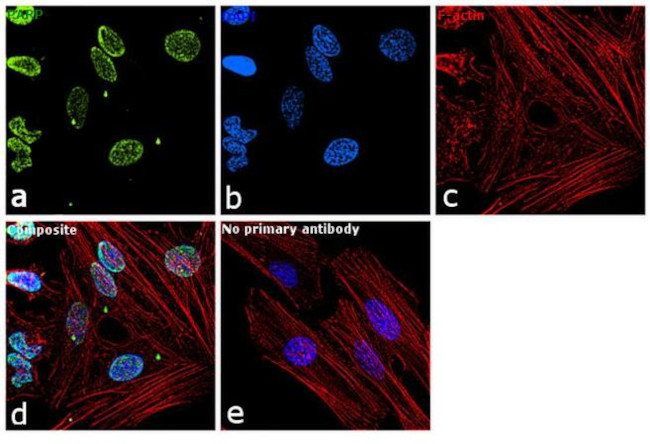 PARP1 Antibody in Immunocytochemistry (ICC/IF)