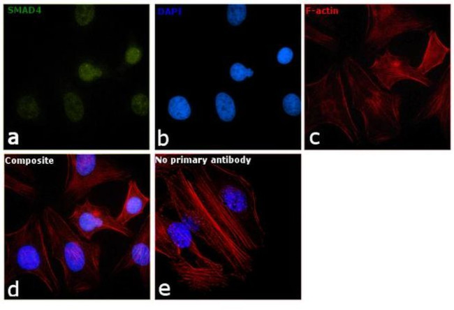 SMAD4 Antibody in Immunocytochemistry (ICC/IF)