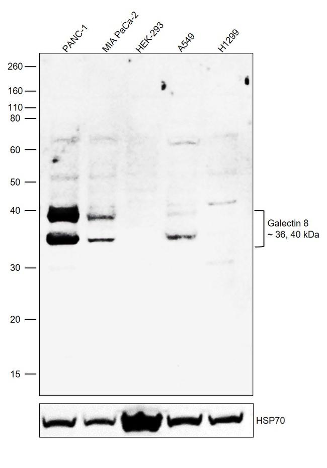 Galectin 8 Antibody in Western Blot (WB)