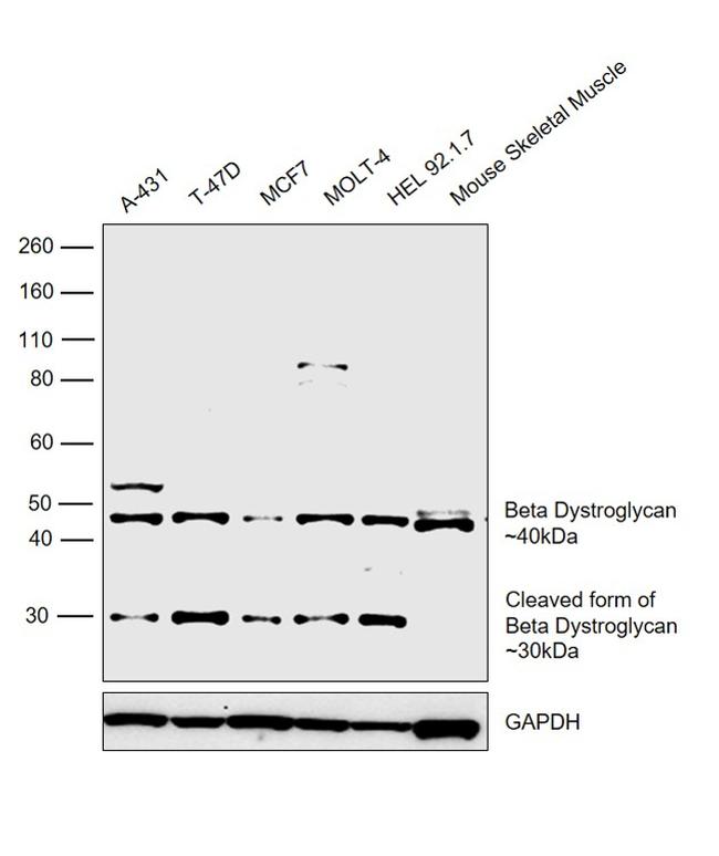 beta Dystroglycan Antibody in Western Blot (WB)