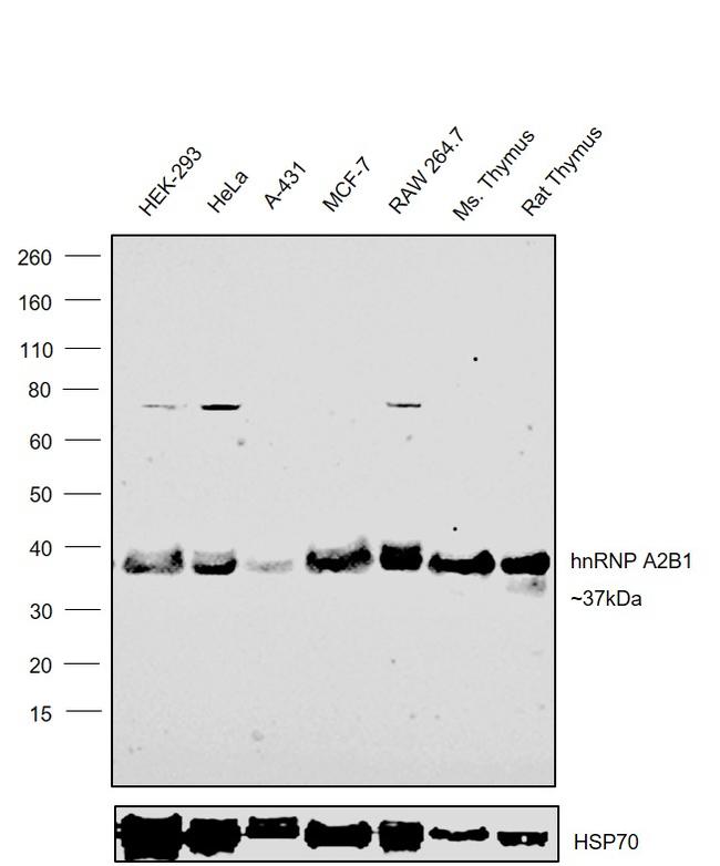 hnRNP A2B1 Antibody in Western Blot (WB)