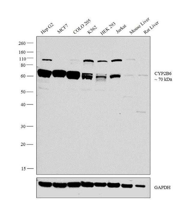 CYP2B6 Antibody in Western Blot (WB)