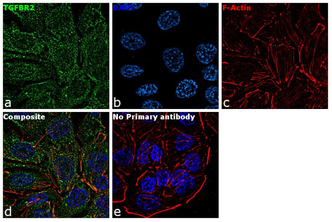 TGFBR2 Antibody in Immunocytochemistry (ICC/IF)