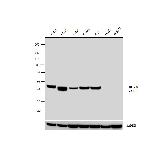 HLA-B Antibody