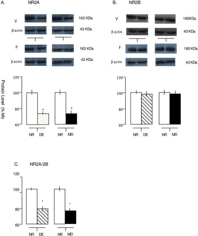 NMDAR2A Antibody in Western Blot (WB)