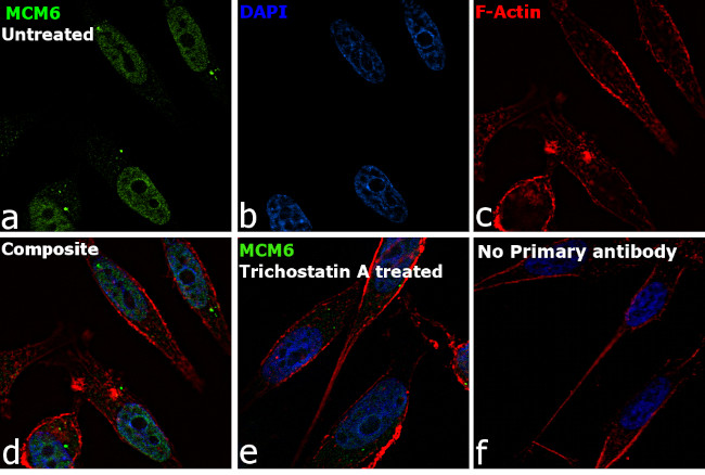 MCM6 Antibody in Immunocytochemistry (ICC/IF)