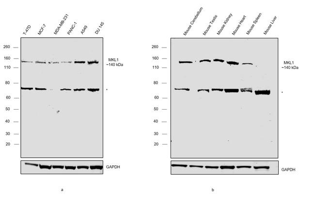 MKL1 Antibody in Western Blot (WB)