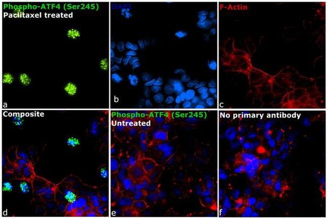 Phospho-ATF4 (Ser245) Antibody