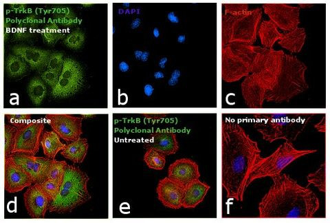 Phospho-TrkB (Tyr516) Antibody in Immunocytochemistry (ICC/IF)