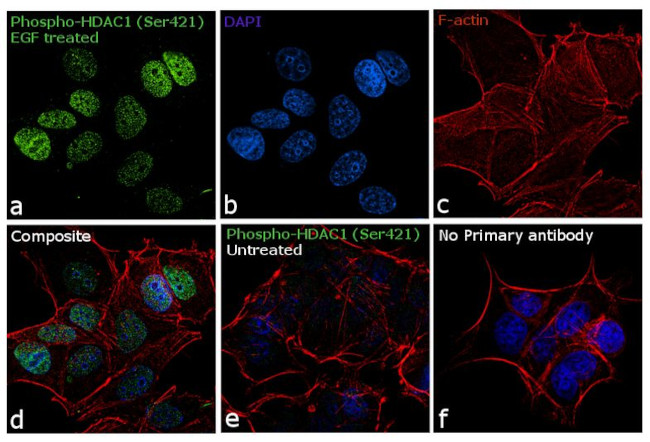 Phospho-HDAC1 (Ser421) Antibody in Immunocytochemistry (ICC/IF)