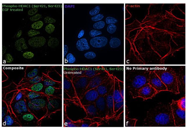 Phospho-HDAC1 (Ser421, Ser423) Antibody