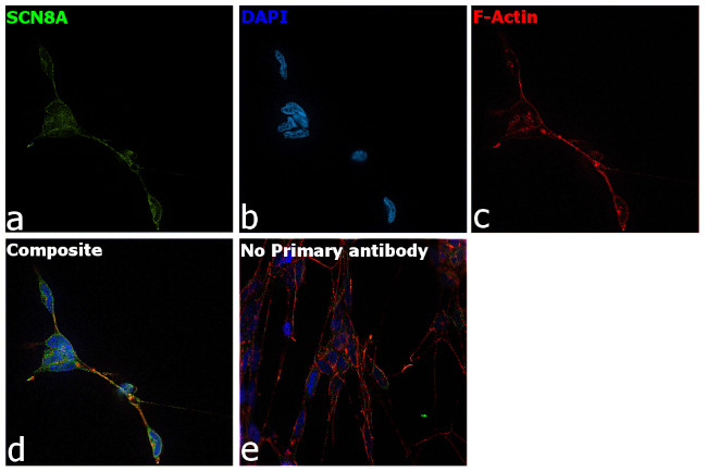 SCN8A Antibody in Immunocytochemistry (ICC/IF)