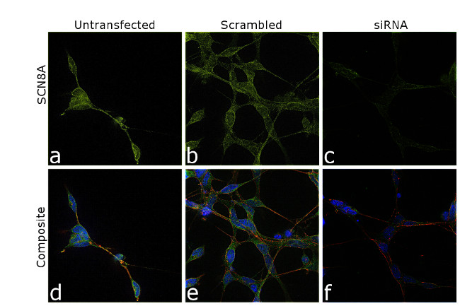 SCN8A Antibody in Immunocytochemistry (ICC/IF)