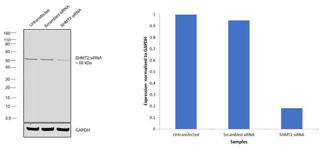 SHMT2 Antibody in Western Blot (WB)