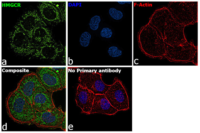 HMGCR Antibody in Immunocytochemistry (ICC/IF)