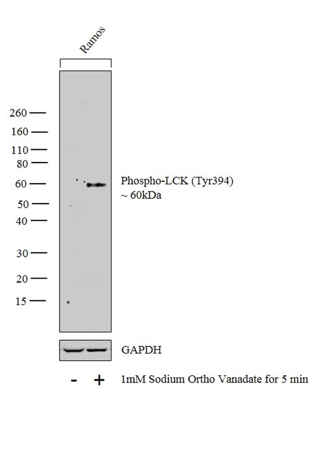 Phospho-LCK (Tyr394) Antibody