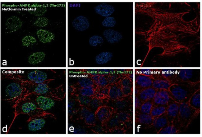 Phospho-AMPK alpha-1,2 (Thr172) Antibody in Immunocytochemistry (ICC/IF)