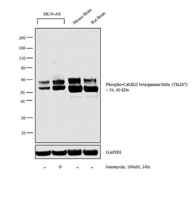 Phospho-CaMKII beta/gamma/delta (Thr287) Antibody