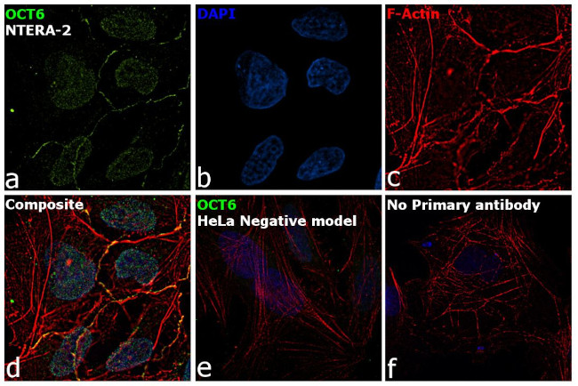 OCT6 Antibody in Immunocytochemistry (ICC/IF)