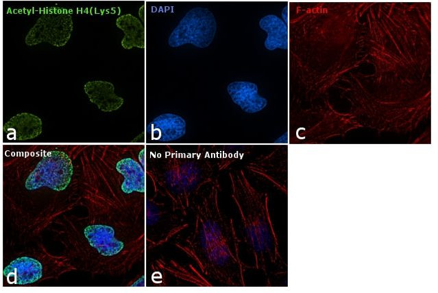 H4K5ac Antibody in Immunocytochemistry (ICC/IF)