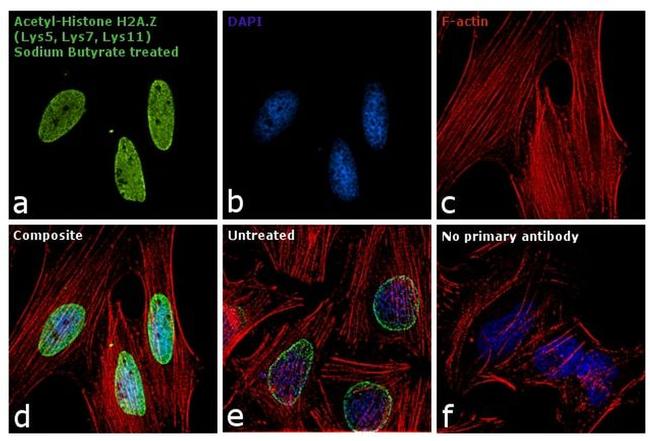 H2A.Zac pan-acetyl (K4,K7,K11) Antibody