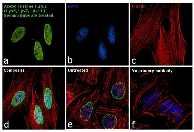 H2A.Zac pan-acetyl (K4,K7,K11) Antibody in Immunocytochemistry (ICC/IF)