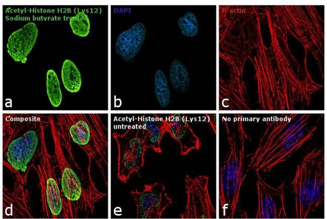 H2BK12ac Antibody